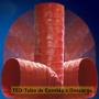 Enviado por visitante em 05/02/2016 - TED - Tubo de Exaustão e Descarga
Tubo Flexível para Sucção e Descarga, indicado para utilização em extração e condução de gases, vapores, ar quente e frio, transporte de granulados, equipamentos de impressão, compressores, entre outras. 

O TED-DINNIL tem excelente flexibilidade, face interna totalmente lisa, reduzindo perdas de carga ao longo da linha. Disponível em medidas até 600mm de diâmetro, suportando temperaturas até 1260ºC. Fabricados em lances de comprimento conforme necessidade e aplicação.