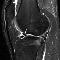 esperei pacientemente com ruptura meniscal...para ser rejeitada e descartada por telefone!!!péssimo o descaso o desrespeito ; os profissionais tyem um currículo médico vastíssimo e notório; mas ficam a desejar em educação moral e cívica;