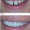 protocolo-de-implantes-DC