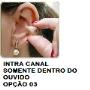 intra canal