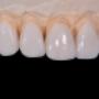 dentista osasco, dentista em osasco, implantes dentários preço, bucomaxilo em osasco, dentista preço