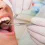 dentista osasco, dentista em osasco, implantes dentários preço, bucomaxilo em osasco, dentista preço
