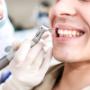 dentista osasco, dentista em osasco, implantes dentários preço, bucomaxilo em osasco, dentista preço