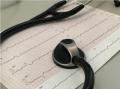 ELETROCARDIOGRAMA