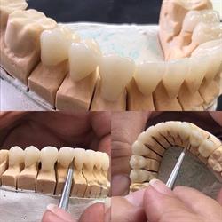 Laboratório para Dentistas e Prótese Dentária Barraqui