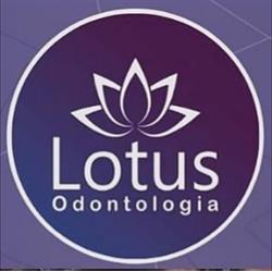 Lotus Itaperuna Clínica Odontológica - Dentista - Implante e Aparelho