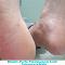 Desbaste-Plantar