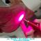 Laserterapia