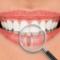 Implantes-Dentários