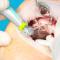 Implantes-sem-Corte