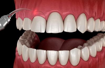 Periodontia