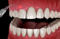 Periodontia