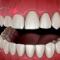 Periodontia