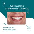 Clareamento dental
