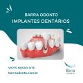 Implantes-Dentários