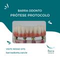 Prótese Protocolo Inferior