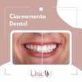 Clareamento dental