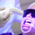 Clareamento Dental a Laser