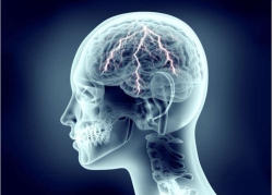 Dr. Marcelo Xavier, Neurologia