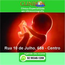 Clinica de Ultrassonografia - Clinison Manaus
