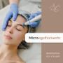 Microagulhamento - esteticista andrea chow clinica de estetica e design de sobrancelha vila mariana