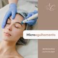 Microagulhamento