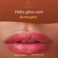 Hidra Gloss com Dermapen