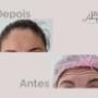 Antes e Depois