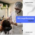 Microagulhamento-capilar