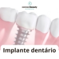 Implante dentário