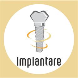 Clínica Implantare