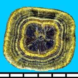 Litolab Mineralogia de Cálculos Urinários