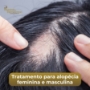 Terapia Capilar
