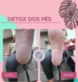 Detox dos Pés