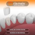 Tratamento de Canal
