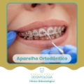 Aparelho Dentário