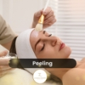 Peeling
