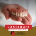 Odonto Excellence | Dentista Caxias do Sul | Clínica Odontológica | Aparelho Ortodôntico