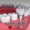 Odonto Excellence | Dentista Sapucaia do Sul | Clínica Odontológica | Invisalign