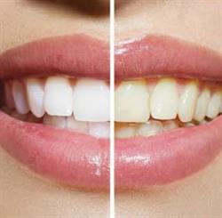 Sorriso Livre Odonto