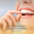 Invisalign