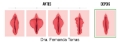 Ninfoplastia