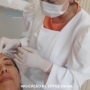 botox