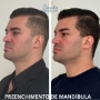 procedimentos