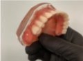 PROTOCOLO, DENTADURA FIXA