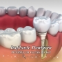 Revitalle Implantes  Dentista Caxias do Sul  Clínica Odontológica  Invisalign