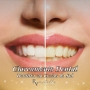 Revitalle Implantes  Dentista Caxias do Sul  Clínica Odontológica  Invisalign