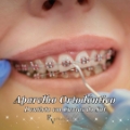 Revitalle Implantes Dentista Caxias do Sul Clínica Odontológica Invisalign
