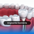 Dr Eduardo Nogueira Dentista Tijucas Clínica Odontológica Odontologia Especializada