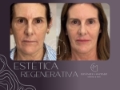 Estética Regenerativa